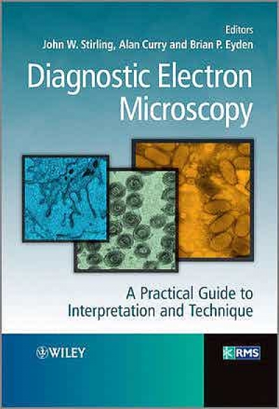 Diagnostic Electron Microscopy - A Practical Guide to Interpretation and Technique (J. W. Stirling, A. Curry, B. P. Eyden)